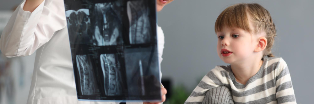 Skolioza u Dzieci – Jak ją Rozpoznać i Kiedy Iść do Fizjoterapeuty - Therapy Zone